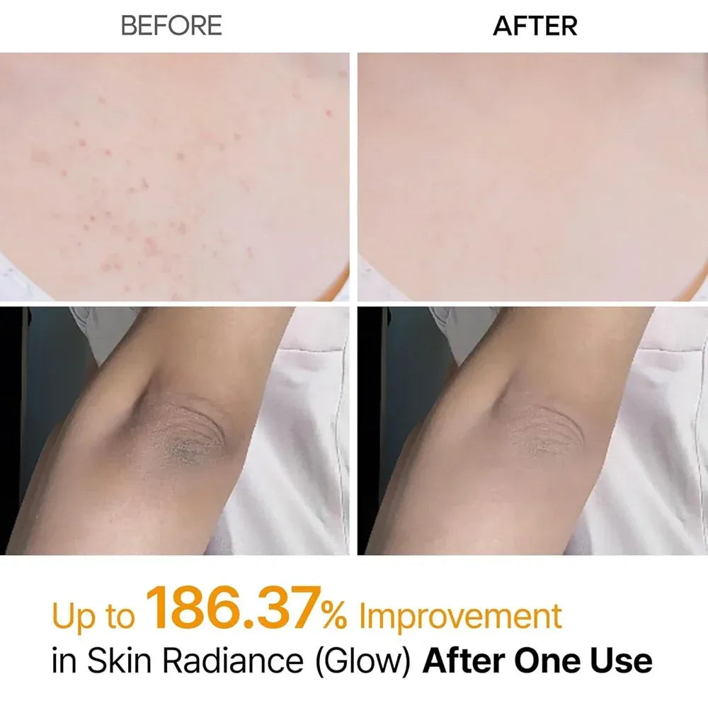 Dr.Melaxin Peel Shot - 60 Second Body Exfoliating Spray