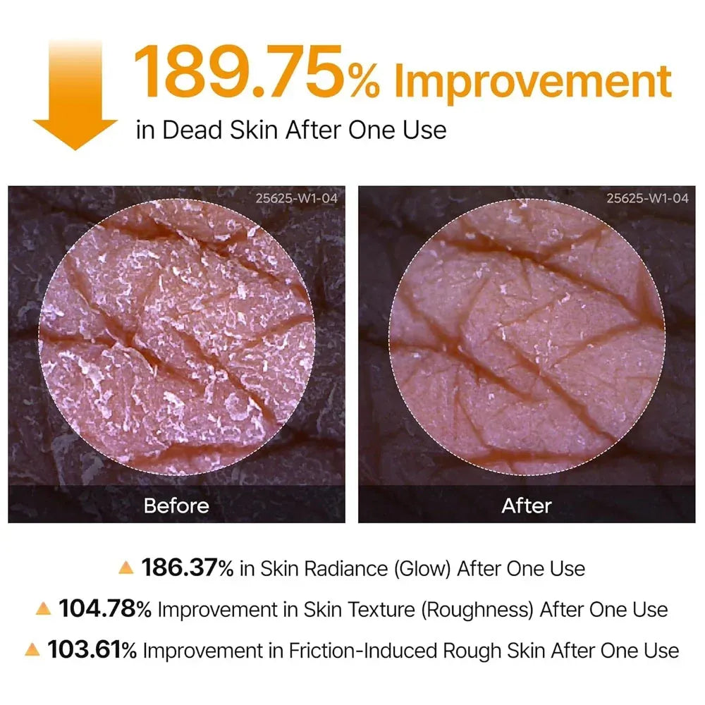 Dr.Melaxin Peel Shot - 60 Second Body Exfoliating Spray